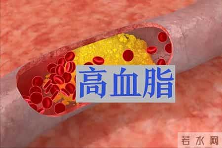 血脂高要马上停止吃这6种食物，很多人天天吃，当心越吃越虚