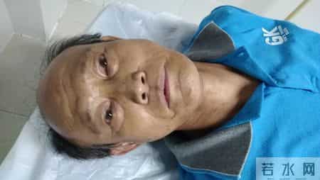 惰性淋巴瘤、侵袭性淋巴瘤，哪个更危险？