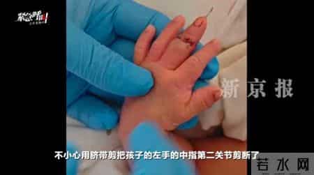 评论丨剪脐带剪断手指还怪婴儿乱动，别让事故再剪断了信任