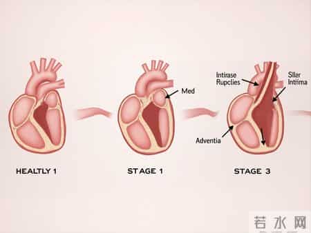 吸烟又火了？医生发现：血压高吸烟时，多留意5点，有益健康