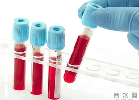 在血常规检查中，知名专家：这2项数值异常，可能是肿瘤信号！