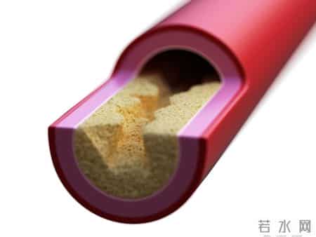 一勺猪油等于五副药？医生劝告：高血压患者吃猪油，要牢记这3点