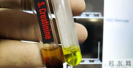 睡觉时出现4种异常，是肾在喊救命！不注意，容易熬成尿毒症