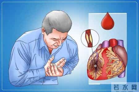 心梗发作 5 个预警信号！忠告：出现一个就就医，别拖延黄金时间