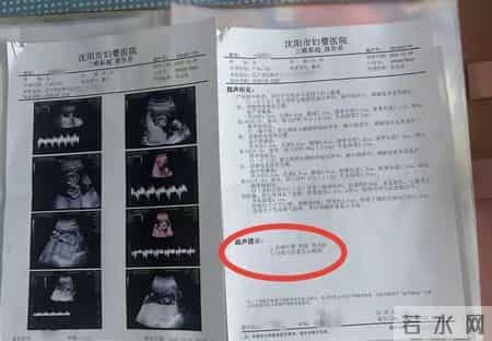 万万没想到！辽宁一孕妇两个月内从一胎变四胞胎