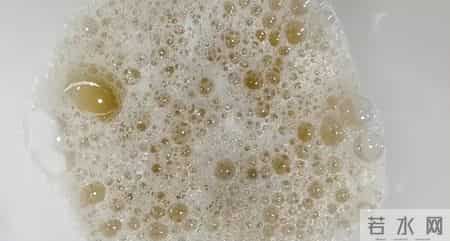 睡觉时出现4种异常，是肾在喊救命！不注意，容易熬成尿毒症