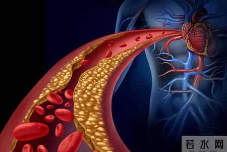 多名医生忠告：高血脂患者做完血脂四项检测，务必牢记 4 关键结果
