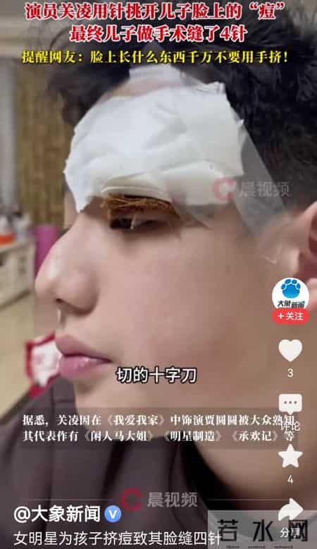 关凌为子挤痘缝4针！真心劝各位家长，别再瞎动手了
