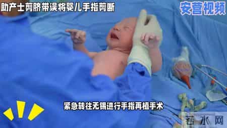 新生儿剪脐带被助产士煎断手指