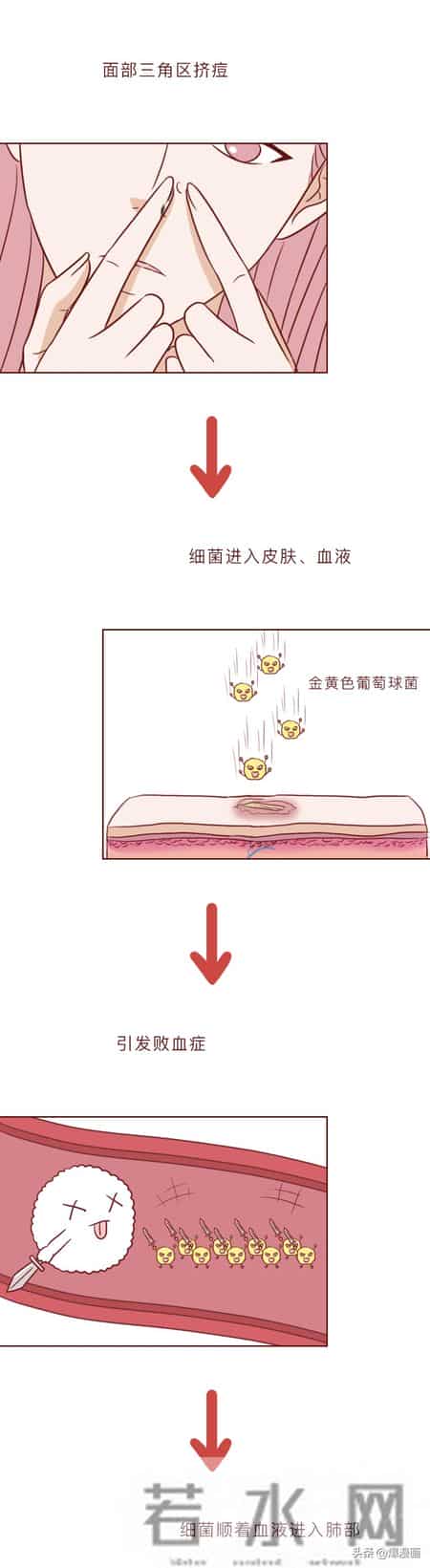 因为这个小动作，我差点被送进ICU，甚至有人被颅内感染