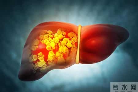 医师调查发现：每日饮酒的糖尿病人，多数临近62岁或有3种异样