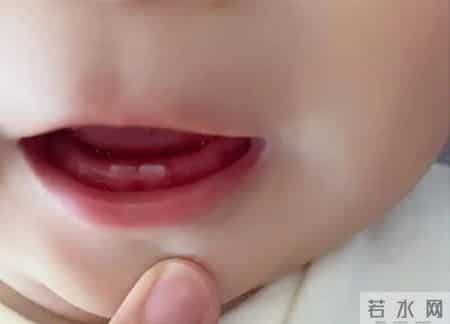 宝宝出牙晚？别急着补钙，找准原因才是关键