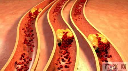 医生提醒：若是查出高血压，这四物马上停止食用，千万别害了自己