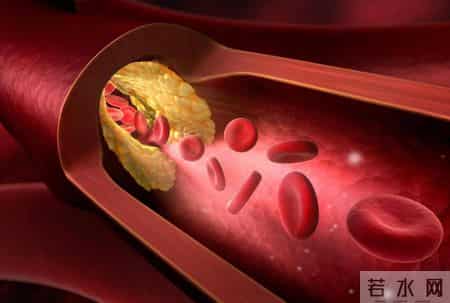 橙子再次被关注！医生发现：常吃橙子的冠心病患者 或出现4种变化