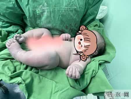 12斤“巨大儿”降临！医生提醒：孕期控糖刻不容缓