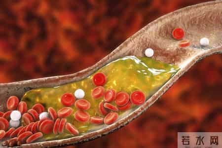 医生发现：天天走路锻炼的糖尿病人，不用几月，身体或迎来8变化