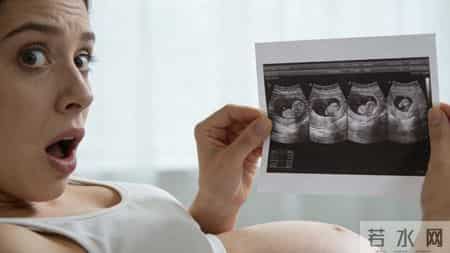 一胎变四胎！70万分之一的奇迹