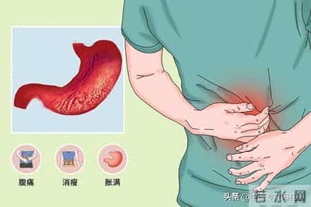 萎缩性胃炎的并发症，不但能治，还非常好治。