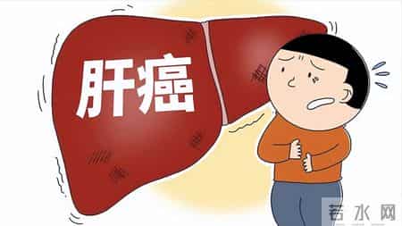 肝癌进展 5 个预警信号！忠告：出现一个就就医，别错过干预时机