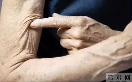 研究发现：57岁后常吃鸡蛋，患肝癌风险是不吃鸡蛋的数倍？真的吗