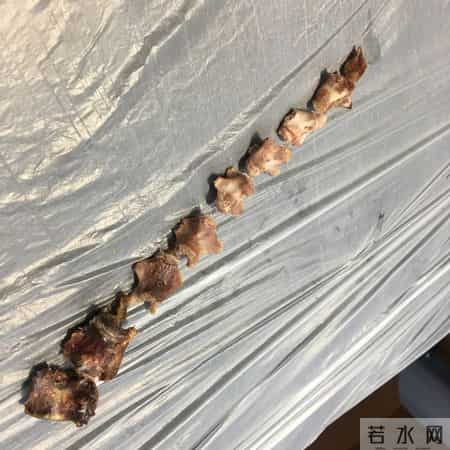 甲状腺癌手术很成功，病人却活不长？医生：很多人忽视术后这几事
