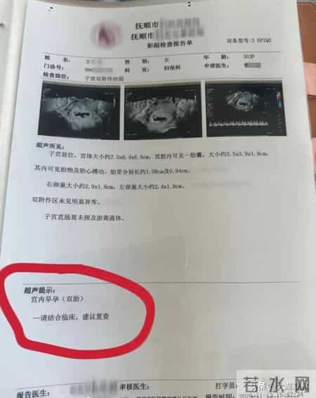 辽宁一孕妇每次产检都多出一胎，两个月内从一胎变四胞胎，医生：概率1300万至1500万分之一