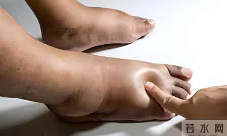 60岁后还能活多久，看排尿就知？排尿有5习惯，活不久？听分析