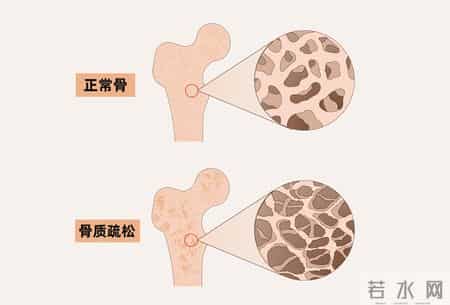 医生提醒：咖啡不单单是血栓杀手，常喝咖啡还容易患上4类疾病？