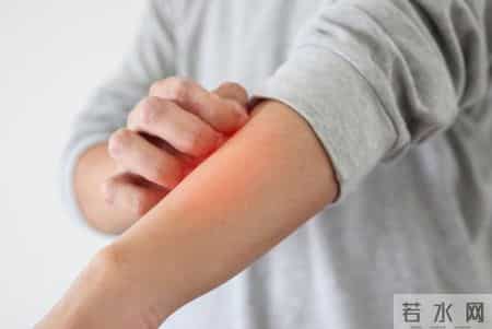 42岁男子皮肤瘙痒，以为是过敏，去医院体检，专家：怎么早不来？