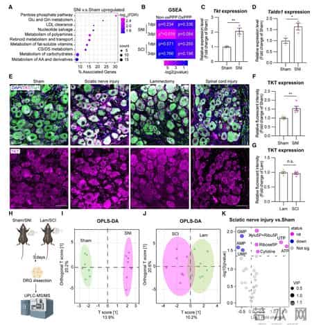 神经修复的“代谢开关”：给点“糖”，让受损神经再生长