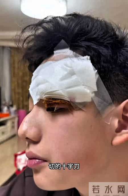 关凌深夜致歉儿子：一失手缝四针的愧疚，藏着天下父母育儿必修课