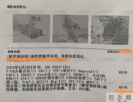 自2026年起，体检发现是癌症早期的患者，千万重视做好这4项准备