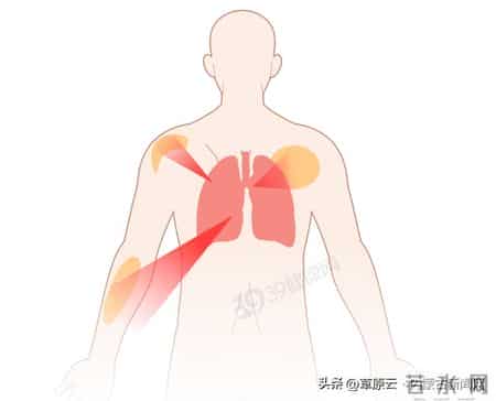 长期咳嗽，外加双腿出现这 3 个症状，可能是肺部已经癌变！千万别不重视
