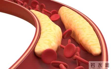 玉米是胆固醇的杀手？医生提醒：胆固醇高的人，3样素菜最好少吃