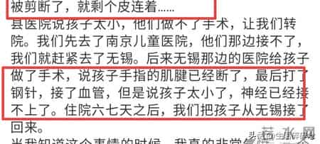 新生儿被剪断手指后续-监控处于死角，院方轻描淡写，父亲发声！