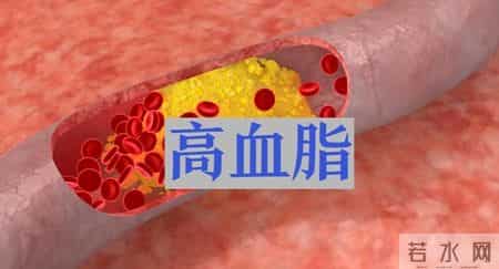 间隔一天吃他汀，降脂效果更好？医生建议：服用他汀，谨记这9项