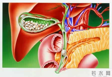 人切除胆囊，这5种病或盯上你，最后一个很危险！别轻易决定切除