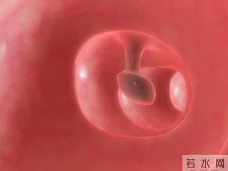 为什么很多人不愿做肠镜？医生：做一次肠镜，或能保你5年没问题