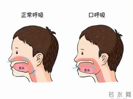 孩子睡觉总张嘴？腺样体面容真会变丑？医生拆解3大认知误区