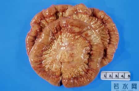 一听到“血液病”就慌？别怕这4种常见类型，管好了和正常人一样