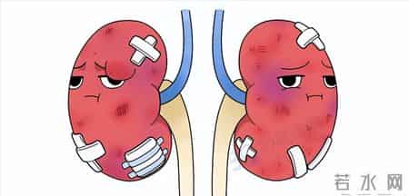 多名医生忠告：慢性肾病患者做过尿检，务必重点看这4项核心结果