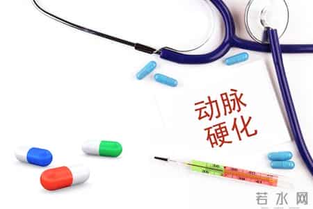 我国超2亿人查出颈动脉斑块！医生提醒：斑块可逆转，这5点很关键