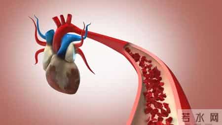 高龄老人不用吃他汀？权威研究：70岁以上高危者吃了更长寿