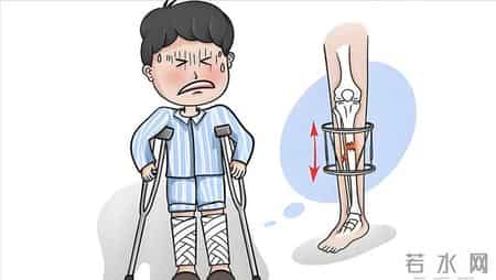 老人因钙不足骨折住院！医生提醒：平时少吃点腌菜，要多吃几物