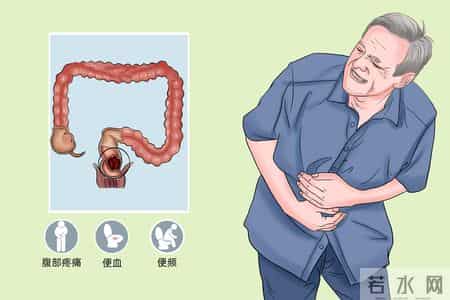 结直肠癌转移 5 危险信号！忠告：出现一个就就医，别耽误诊疗时机