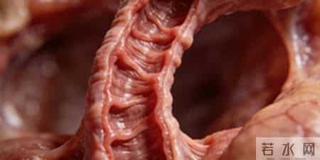 女子确诊反流性食管炎，医生：这些习惯或加重病情，大家都要注意