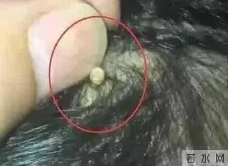 妈妈给女儿梳头发现“小米粒”，急忙带娃去检查，医生：来得及时