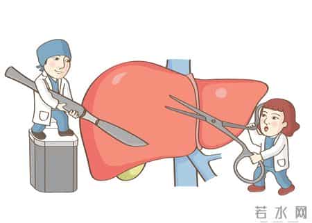 肝癌进展 5 个预警信号！忠告：出现一个就就医，别错过干预时机