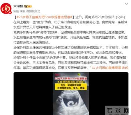 23岁男子信偏方把5cm水蛭塞进尿道致剧烈疼痛、排尿困难，就医后通过手术取出异物