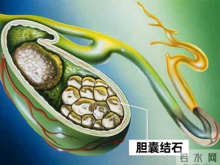 一手术人就垮了？医生直言：6种病无需做手术，别让无知害了自己